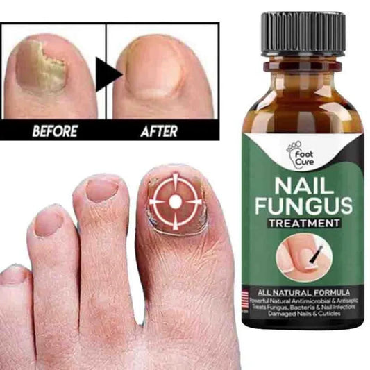 Nail Fungal Repair Serum | Nail Fungus Removal Gel 6 Reviews